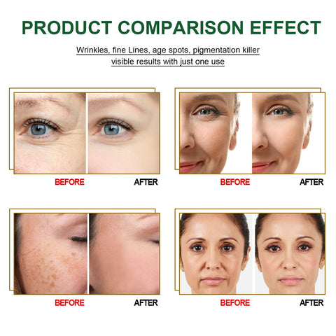 Anti-Aging Serum Face Serum Mask For Moisturizing-Veeddydropshipping