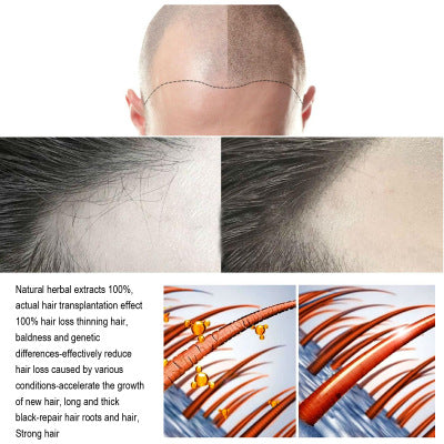 Anti-head Long Essence To Strengthen Hair4