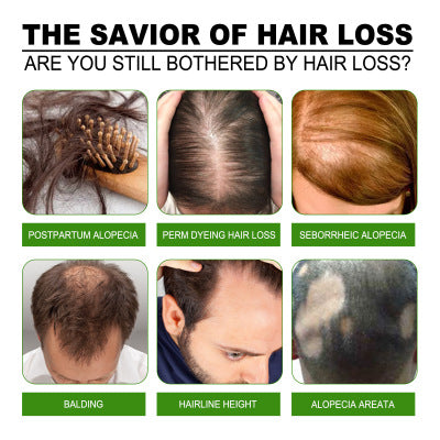Anti-head Long Essence To Strengthen Hair5