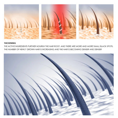Anti-head Long Essence To Strengthen Hair6