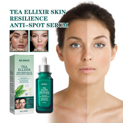 Brightening And Lightening Melasma Blemish Moisturizing And Brightening Skin Essence2