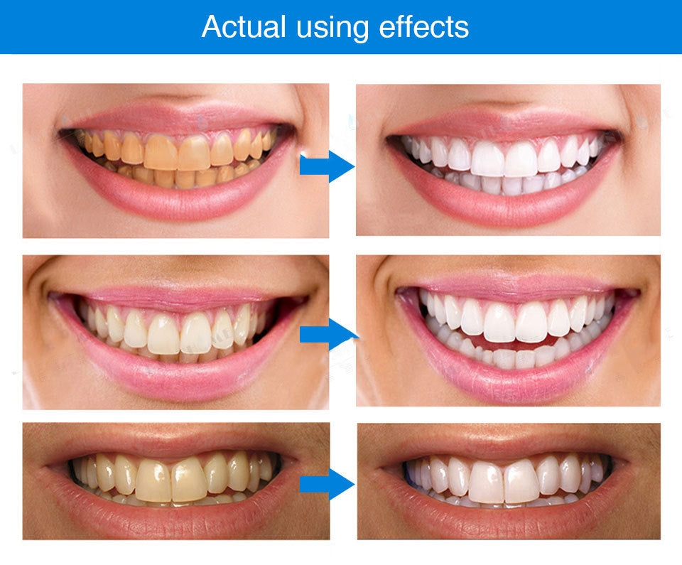 Dental pen for cleaning teeth-3