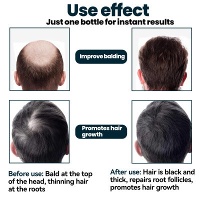 Men's Hair Growth Liquid Care Anti-drop Thick Moisturizing Essence4