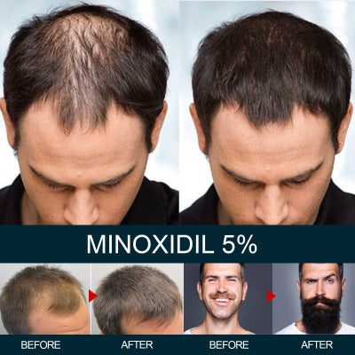 Men's Hair Growth Liquid Care Anti-drop Thick Moisturizing Essence5