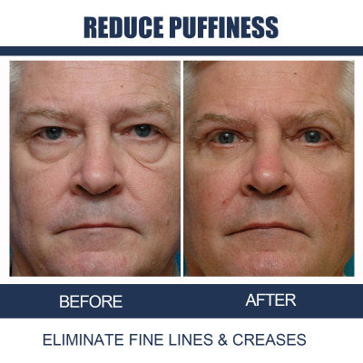 Men's Retinol Firming And Lightening Dark Circles Moisturizing Eye Cream-3