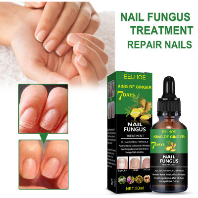 Nail Repair Solution Hand Foot And Nail Care Solution-2