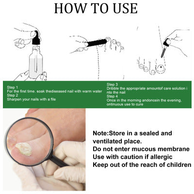 Nail Repair Solution Hand Foot And Nail Care Solution-4