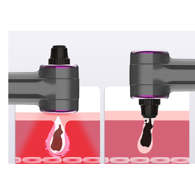 New Electric Blackhead Suction Device For Use Pores4