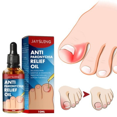 Soft And Bright Nail Repair Inlay And Thickening Type Grey Groove Care Oil2