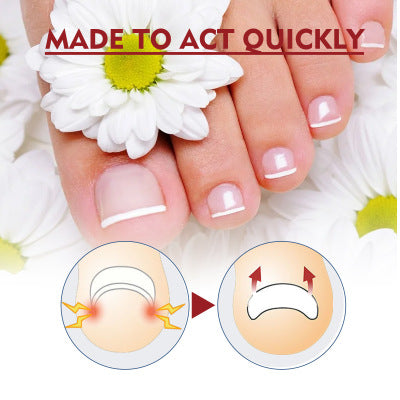 Soft And Bright Nail Repair Inlay And Thickening Type Grey Groove Care Oil4