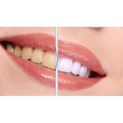 Teeth Whitening Pen Remove Plaque And Tartar Clean The Mouth Tooth Brushing Essence5