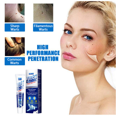 Zhongcao Keyou Liquid Skin Warts Ordinary Yukeyou Ointment Wart Removing Cream-3