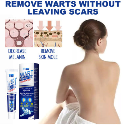 Zhongcao Keyou Liquid Skin Warts Ordinary Yukeyou Ointment Wart Removing Cream-4