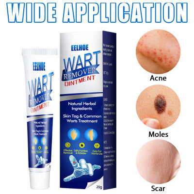 Zhongcao Keyou Liquid Skin Warts Ordinary Yukeyou Ointment Wart Removing Cream-5