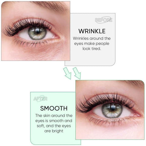 Eye Patches Anti Wrinkles Remove Dark Circles-BH00261-Veeddydropshipping