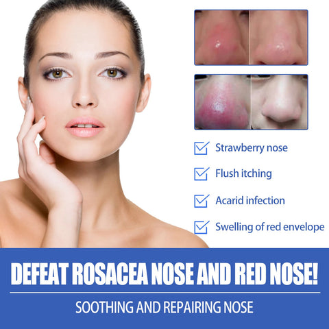 Remover Serum Treatment Liquid Mark Anti Nose Mites-BH00232-Veeddydropshipping