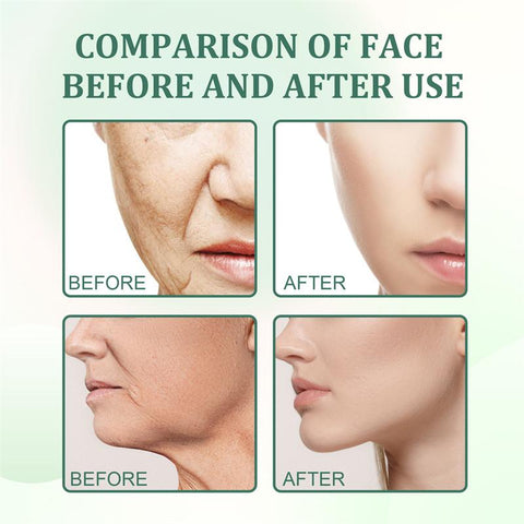 Vitamin c Boost Serum Anti-Aging Skin Care-BH00238-Veeddydropshipping