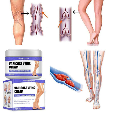 Treatment Cream Relieve Tired Legs Dilated-BH00299-Veeddydropshipping