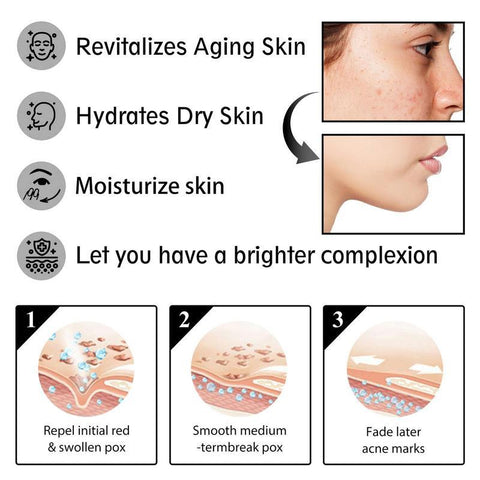 Cream Day Night Moisturizer Snail Mucin Extract-BH00218-Veeddydropshipping