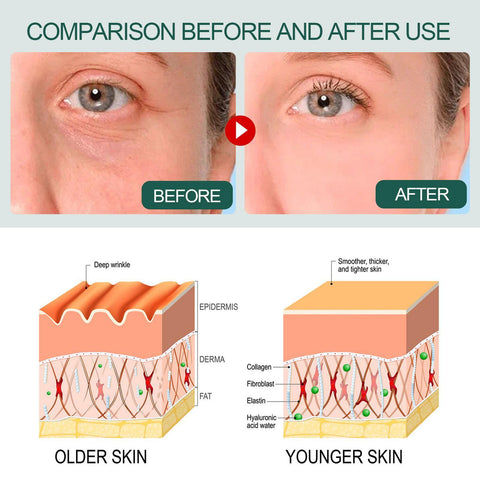 Advanced Deep Anti-wrinkle Serum-BH00198-Veeddydropshipping