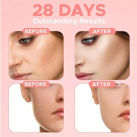Serum 30% Vitamin C with HA Skin-BH00337-Veeddydropshipping