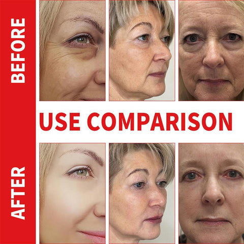 Anti Aging Stayeve Face Serum  Oil-BH00212-Veeddydropshipping
