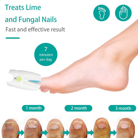 painless nail fungus therapeutic instrument Laser foot care-BH00883-Veeddydropshipping