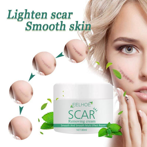 Scar Removal Cream Scald Burn-ScarsBH00307-Veeddydropshipping
