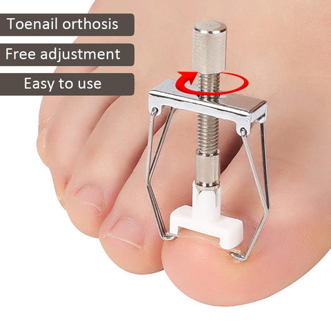 Toenail Fixer Orthotic Kit Pedicure Curly Embed-BH00875-Veeddydropshipping