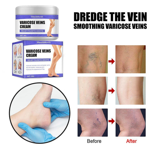 Treatment Cream Relieve Tired Legs Dilated-BH00299-Veeddydropshipping