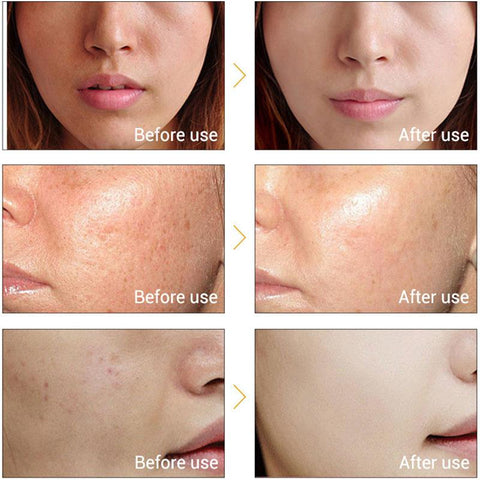 Whitening Serum lightens  Freckles Melanin Moisturizes-BH00229-Veeddydropshipping