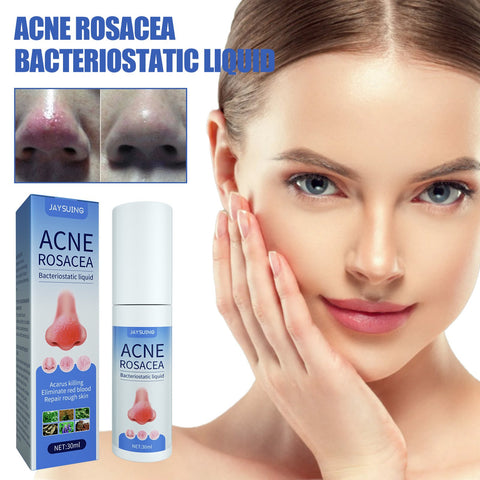 Remover Serum Treatment Liquid Mark Anti Nose Mites-BH00232-Veeddydropshipping