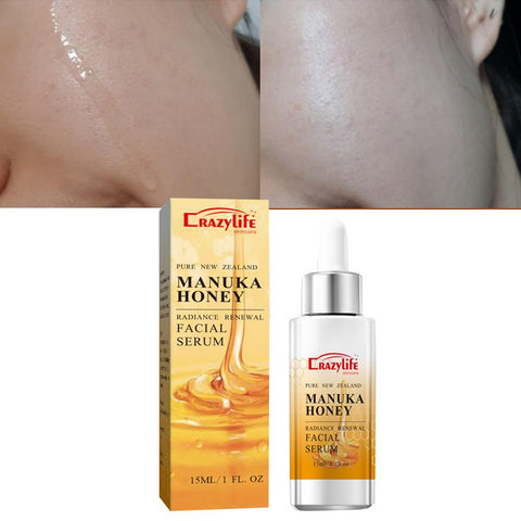 Essence Moisturizing Oil Anti-wrinkle Face Serum-BH00236-Veeddydropshipping