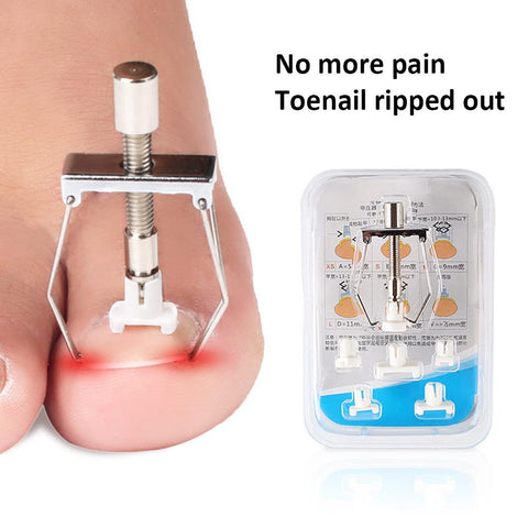 Toenail Fixer Orthotic Kit Pedicure Curly Embed-BH00875-Veeddydropshipping