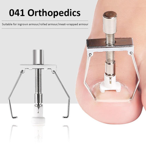 Toenail Fixer Orthotic Kit Pedicure Curly Embed-BH00875-Veeddydropshipping