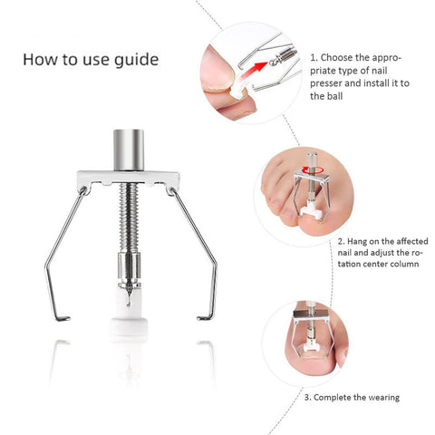 Toenail Fixer Orthotic Kit Pedicure Curly Embed-BH00875-Veeddydropshipping
