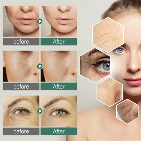 Vitamin c Boost Serum Anti-Aging Skin Care-BH00238-Veeddydropshipping