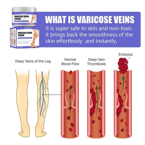 Treatment Cream Relieve Tired Legs Dilated-BH00299-Veeddydropshipping