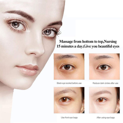 Electric eye massager eye beauty instrument-BH00373-Veeddydropshipping
