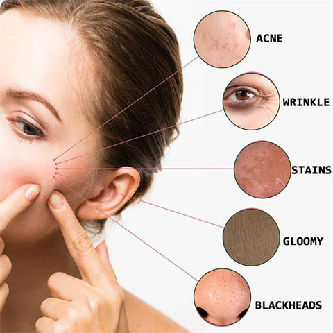Whitening Serum lightens  Freckles Melanin Moisturizes-BH00229-Veeddydropshipping