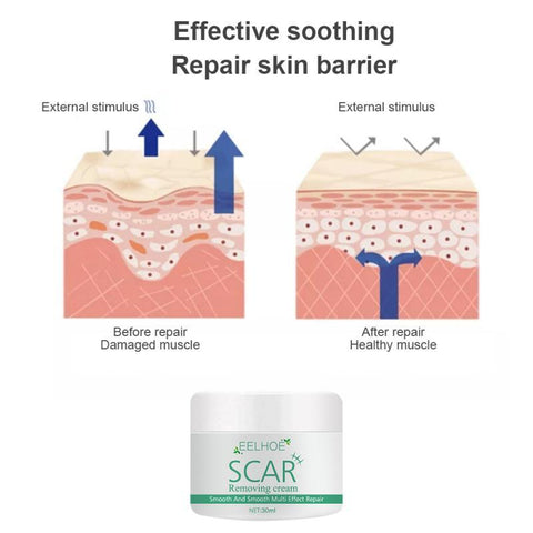 Scar Removal Cream Scald Burn-ScarsBH00307-Veeddydropshipping