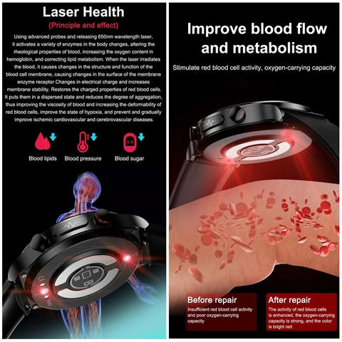 2023 New Smartwatch Blood Sugar Blood lipids Blood Pressure Body-CE00688-Veeddydropshipping