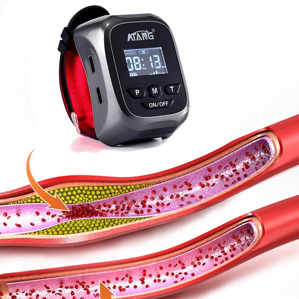 Laser Therapy Watch Physiotherapy for Diabetes Hypertension-BH00804-Veeddydropshipping