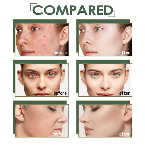 Whitening Serum lightens  Freckles Melanin Moisturizes-BH00229-Veeddydropshipping