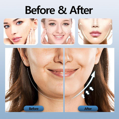 EMS V-Face Electric Shaping Massager-BH00349-Veeddydropshipping