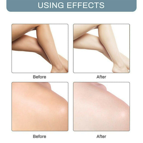 Whitening Cream Skin Lightening Bleaching Cream-BH00325-Veeddydropshipping