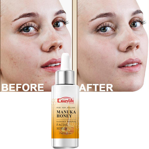 Essence Moisturizing Oil Anti-wrinkle Face Serum-BH00236-Veeddydropshipping