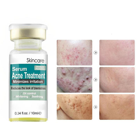 Serum Liquid Coenzyme  Acid And Anti-wrinkles-BH00226-Veeddydropshipping