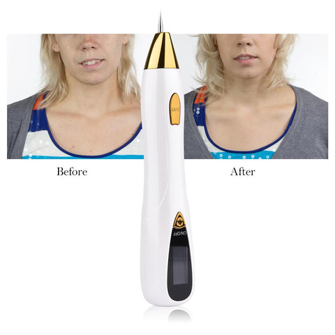 Professional Skin Tag Remover Plasma Pen-BH00366-Veeddydropshipping