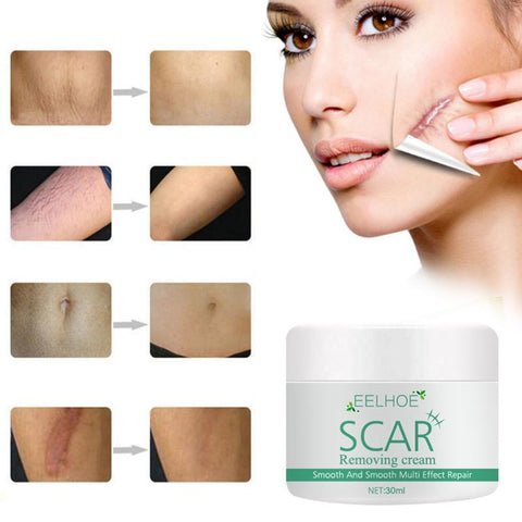 Scar Removal Cream Scald Burn-ScarsBH00307-Veeddydropshipping